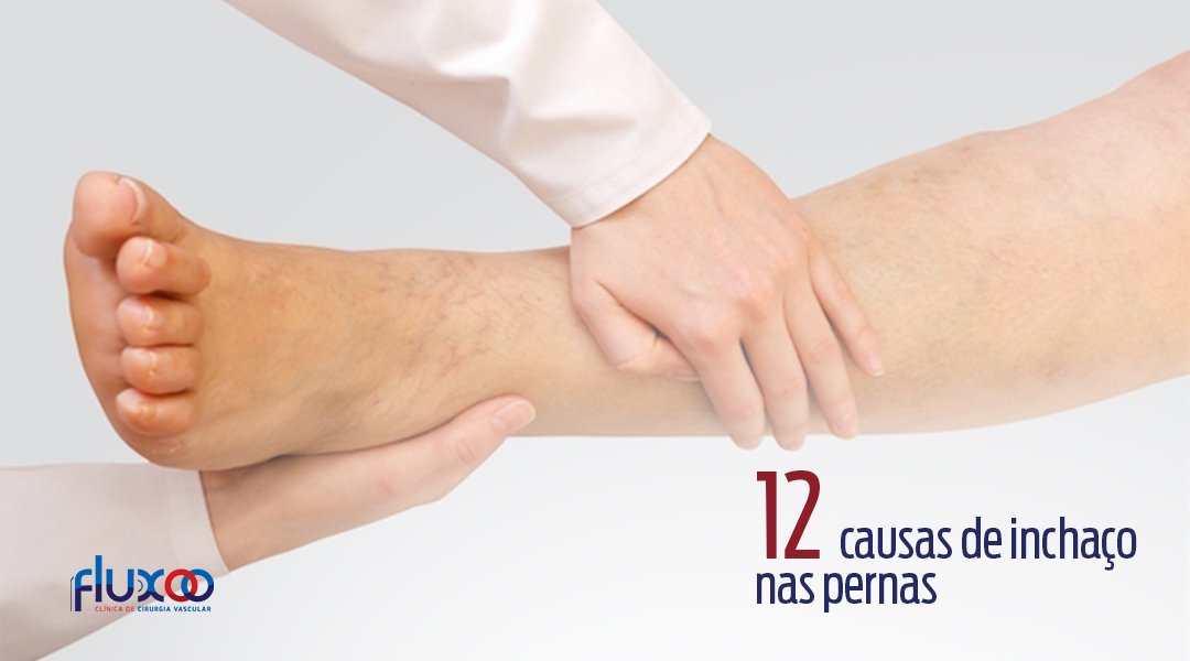 12 causas de inchaço nas pernas 