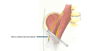 nervo cutâneo femoral lateral -